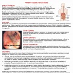 Microsoft Word - SEPA Patient Focus - Crohn's Disease Revised 06